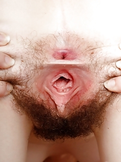 Emma Canadian Hairy Women