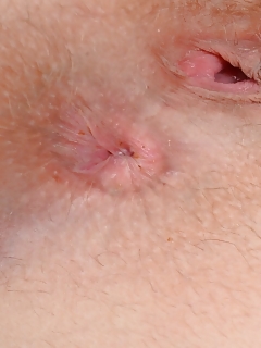 Nickey Hairy Girls Boys